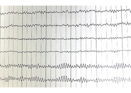 脳波検査2