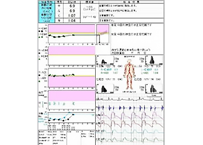 血圧脈波検査2